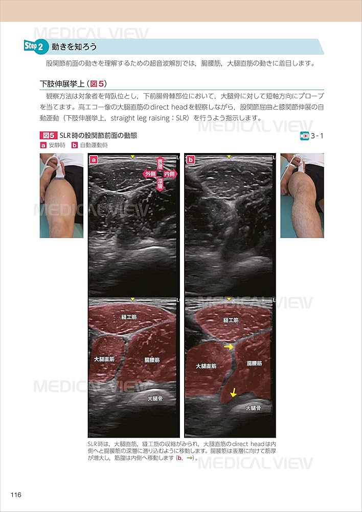 運動学×解剖学×エコー 関節機能障害を「治す!」理学療法のトリセツ 運動学×解剖学×エコー 関節機能障害を「治す！」理学療法の
